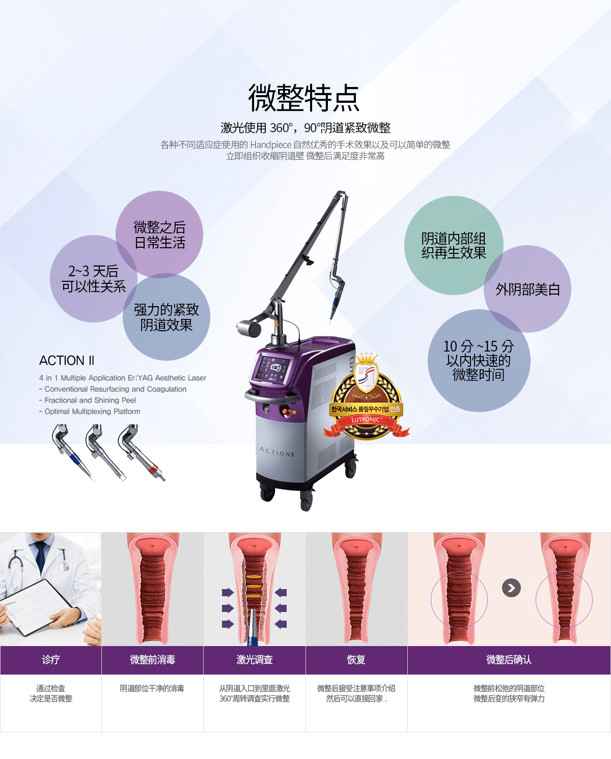 微整特点 激光使用360°，90°阴道紧致微整