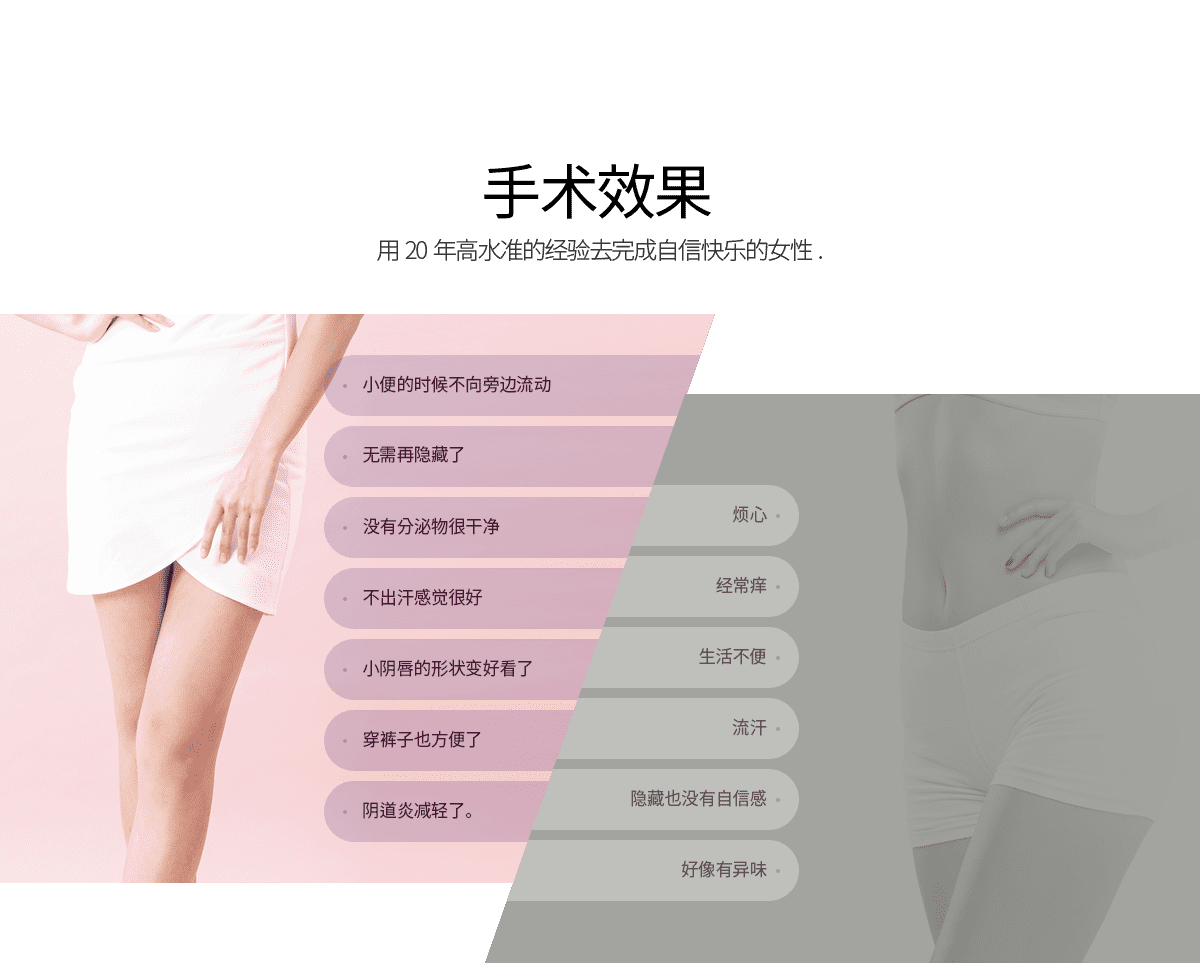 手术效果 用20年高水准的经验去完成自信快乐的女性.